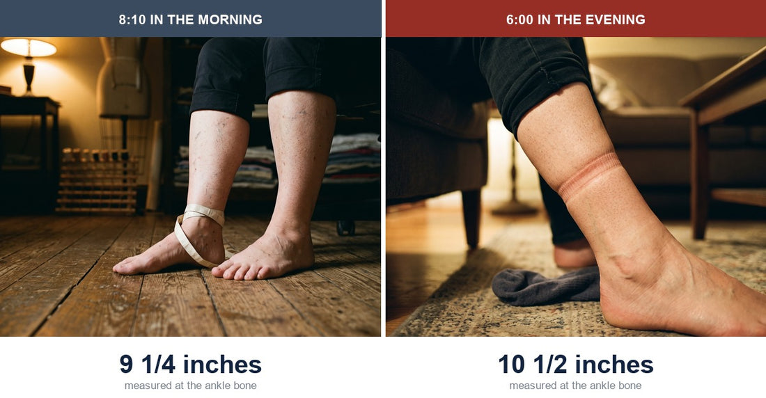 The same ankle measured at 8:10 in the morning and 6:00 in the evening